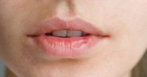 Lèvres gercées : 5 mauvaises habitudes à bannir pour les éviter